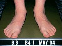 joint mobility treatments